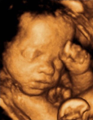 Original ultrasound scan input